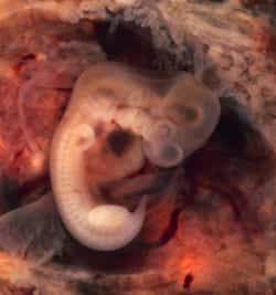 Desarrollo embrionario del bebe Desarrollo embrionario del bebe