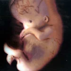 Desarrollo del feto a los 54 dias de gestación