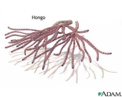 hongo.jpg