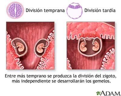 Embarazos múltiples (I) embarazos-multiples.jpg
