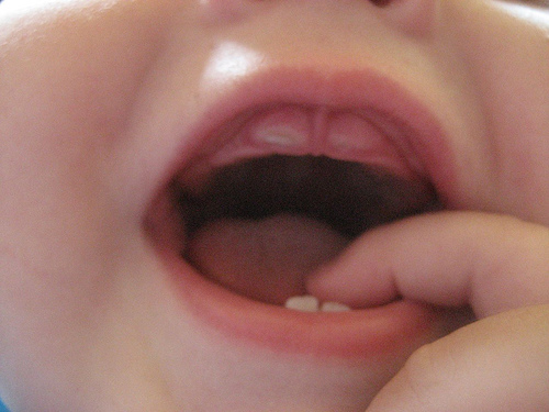 denticion en niños