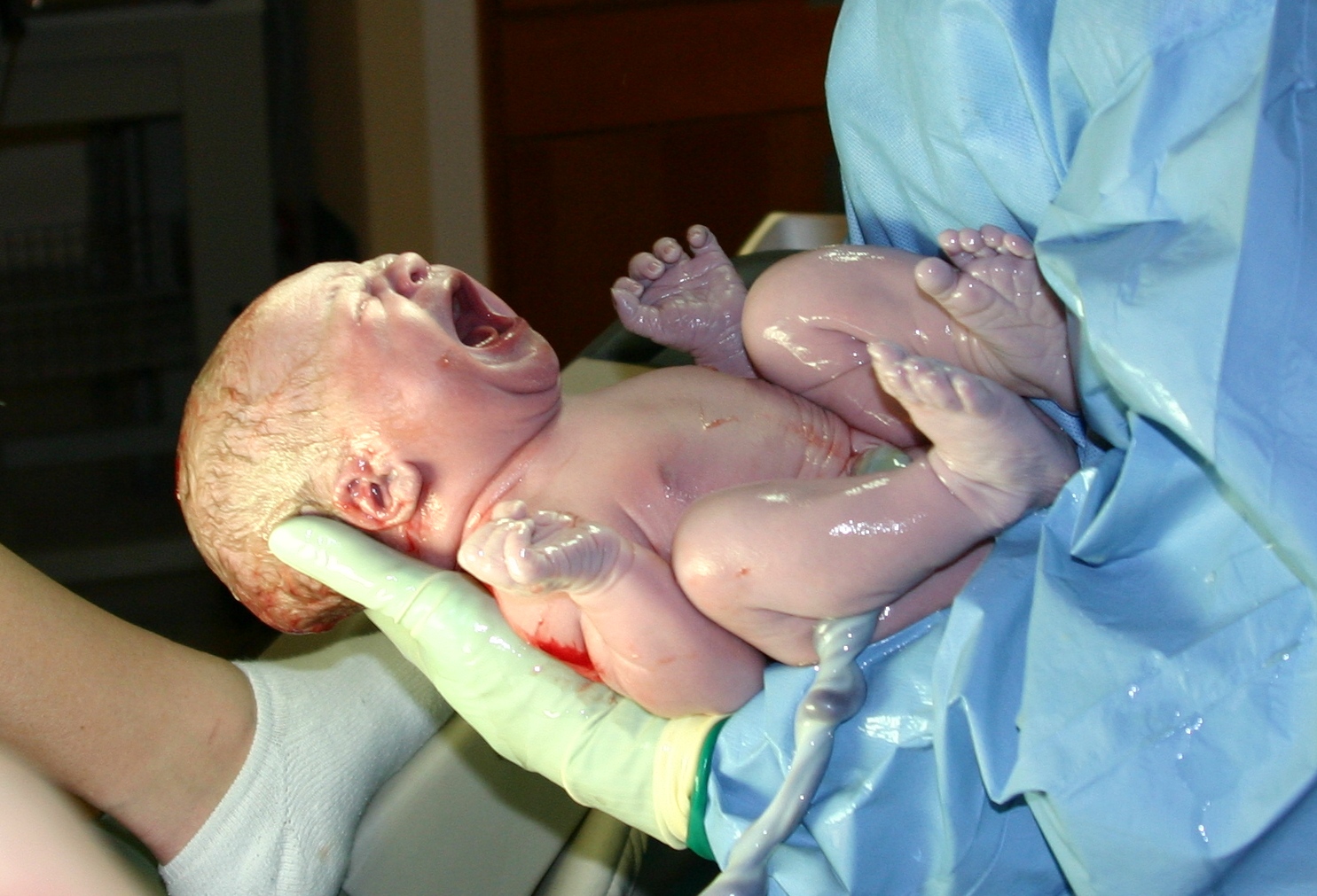 cordón umbilical recién nacido 1