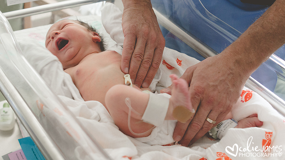 Cuidados cordón umbilical recién nacido