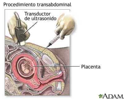 la-placenta