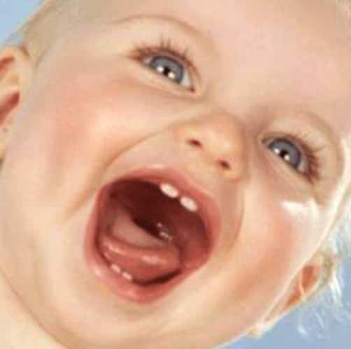 Desarrollo dental del bebé