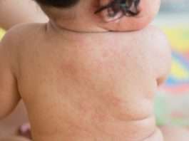 Sintomas De Enfermedad En El Bebe Bebes Y Embarazos