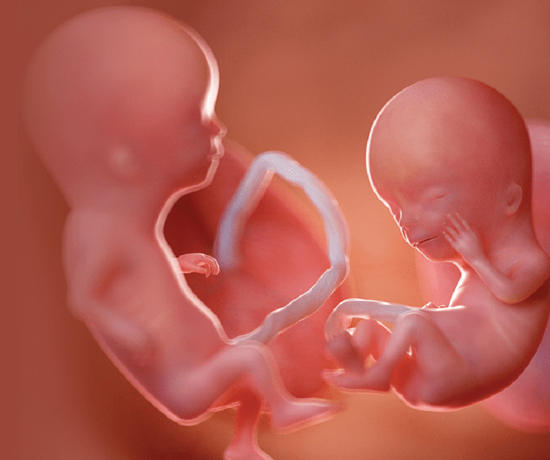 Embarazo múltiple: ¿Qué es?, ¿por qué se produce? y ¿cuáles son sus complicaciones?